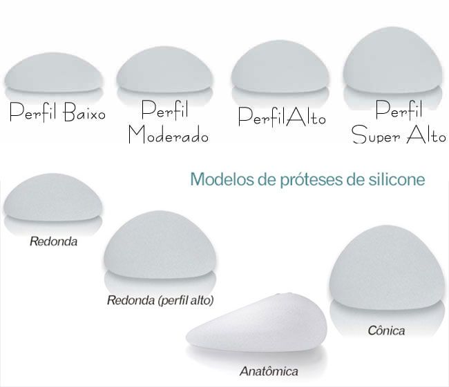 Razilly - Cirurgia Plstica e Neurologia Tipos de Prteses de Mama As próteses de silicone são implantes colocados através de cirurgia plástica nos seios e podem ter como finalidade a reconstrução ou o...